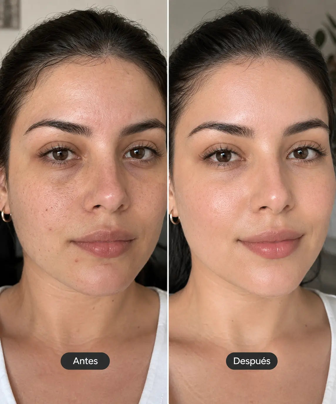 Niacid Serum 30 Ml | Reduce Manchas y Poros Visibles